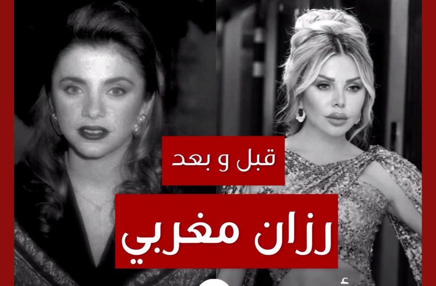 قبل و بعد: رزان مغربي