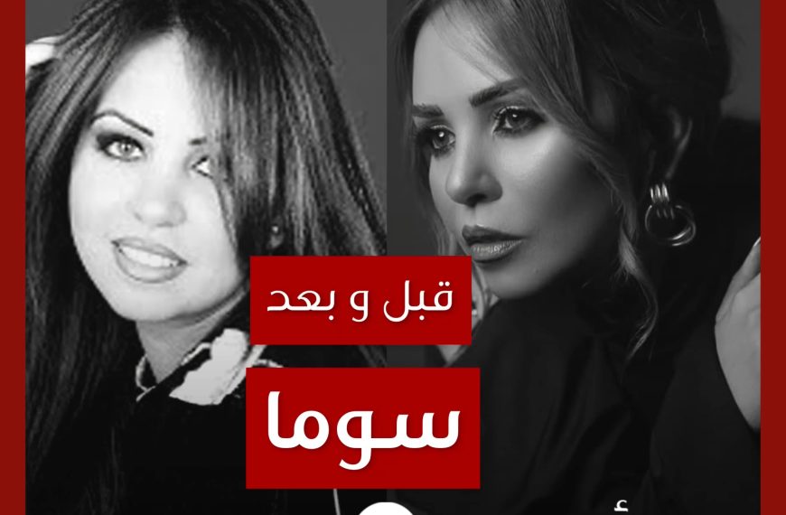 قبل و بعد: سوما