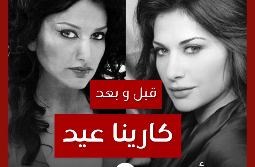 قبل و بعد: كارينا عيد