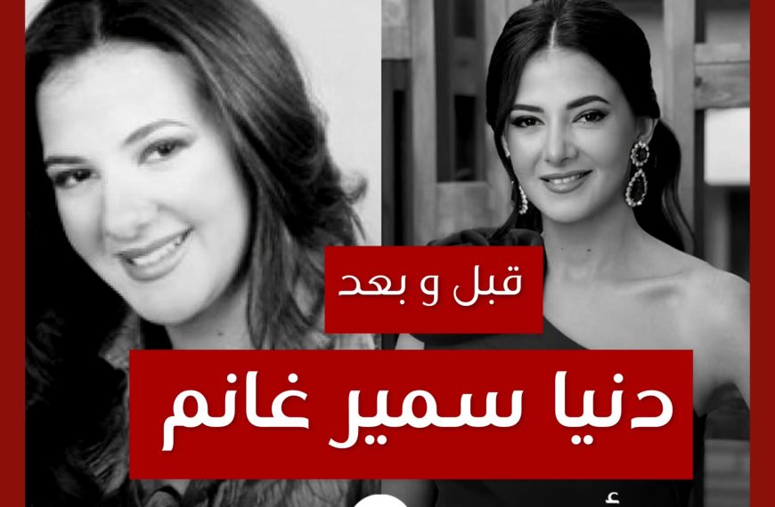 قبل و بعد: دنيا سمير غانم