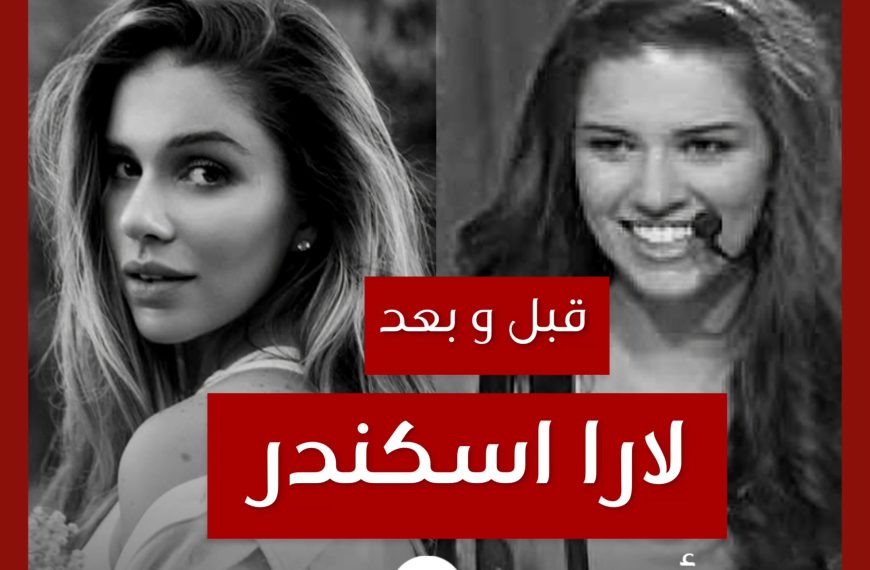 قبل و بعد: لارا اسكندر