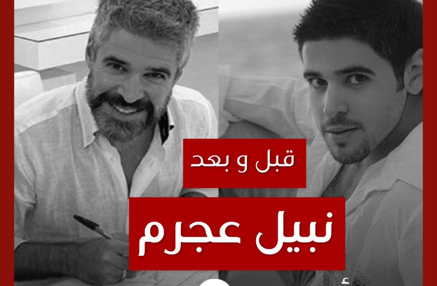 قبل و بعد: نبيل عجرم