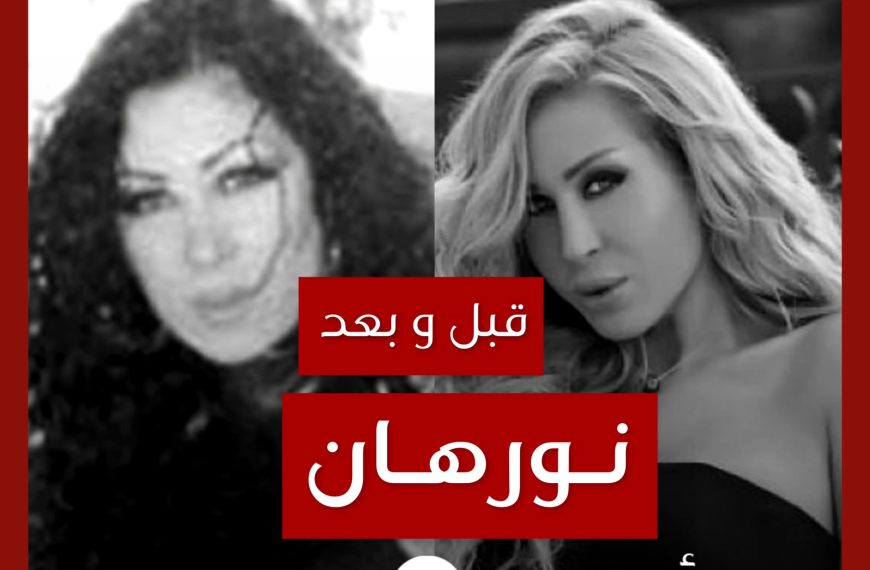 قبل و بعد: نورهان