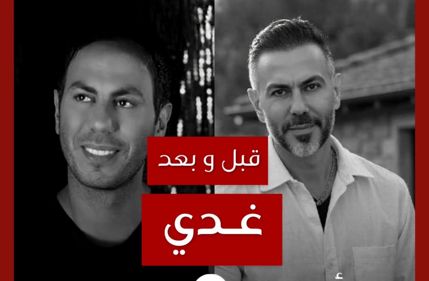 قبل و بعد: غدي