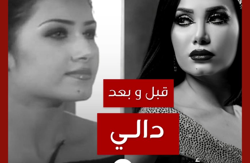 قبل و بعد: دالي