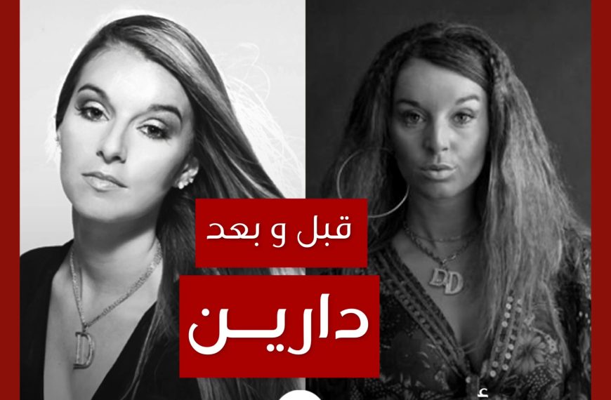قبل و بعد: دارين