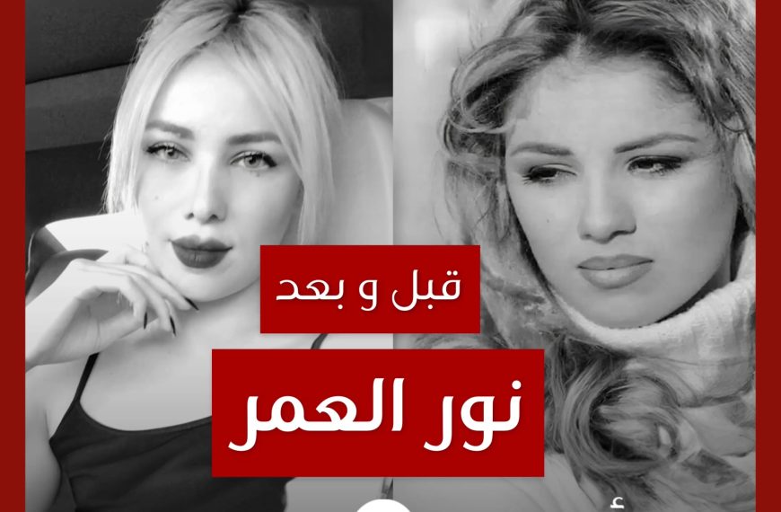 قبل و بعد: نور العمر