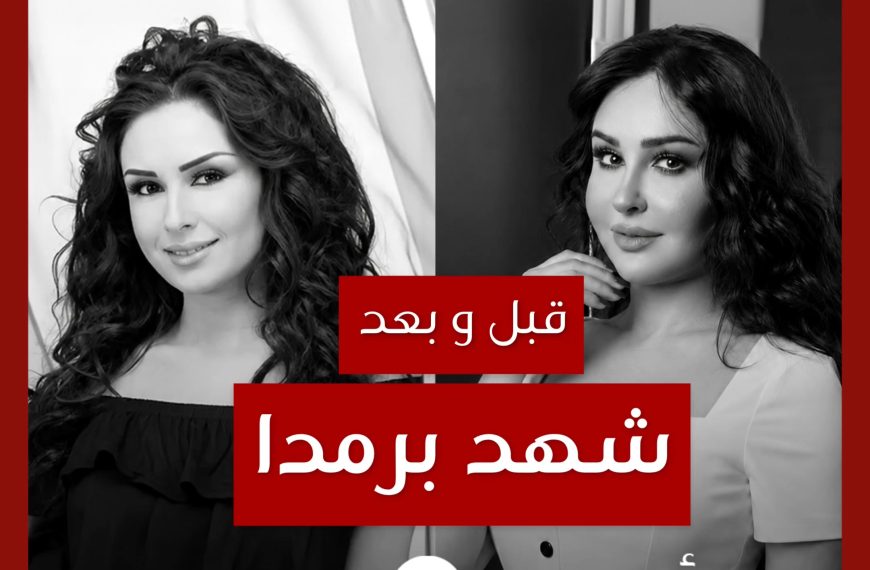 قبل و بعد: شهد برمدا